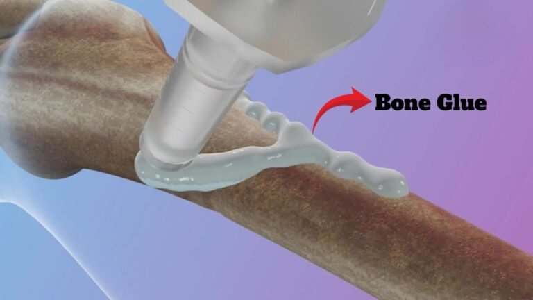 Goodbye To Screws And Plates, Scientists Developed 3-Minute ‘Bone Glue’ That Repairs Broken Bones Naturally